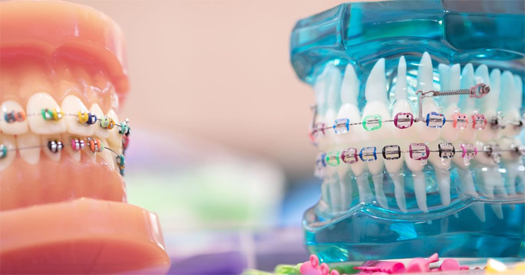 Ortodontik Tedavilerle Sağlıklı ve Düzenli Dişler